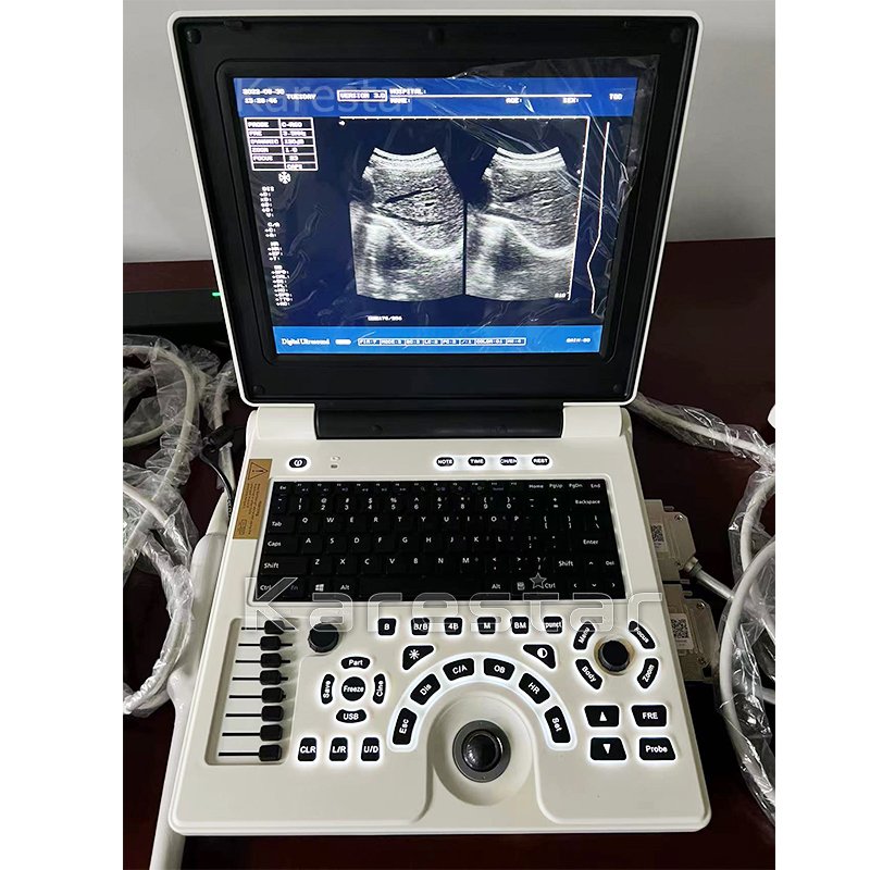 Other Veterinary Instrument K-H100 Veterinary machine cheap vet portable ultrasound used for animal pregnancy scanning