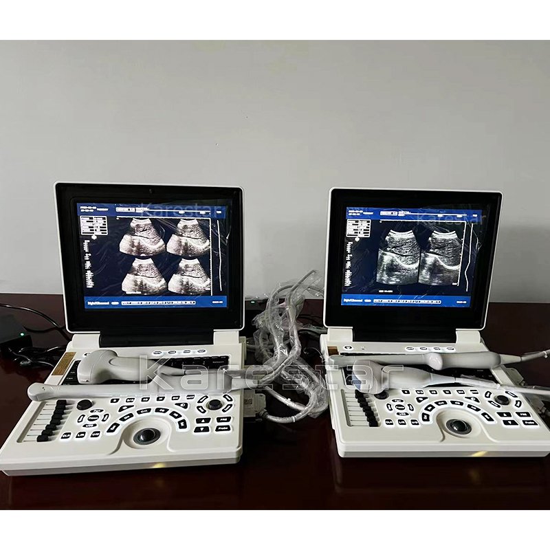 Other Veterinary Instrument K-H100 Veterinary machine cheap vet portable ultrasound used for animal pregnancy scanning