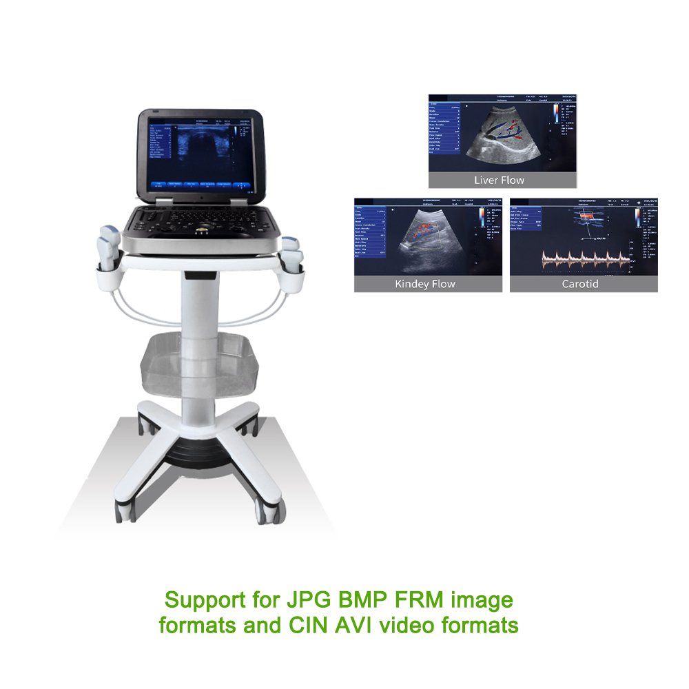 medical equipments Other Veterinary medicine Instrument portable doppler ultrasound scanner machine ultrasonido