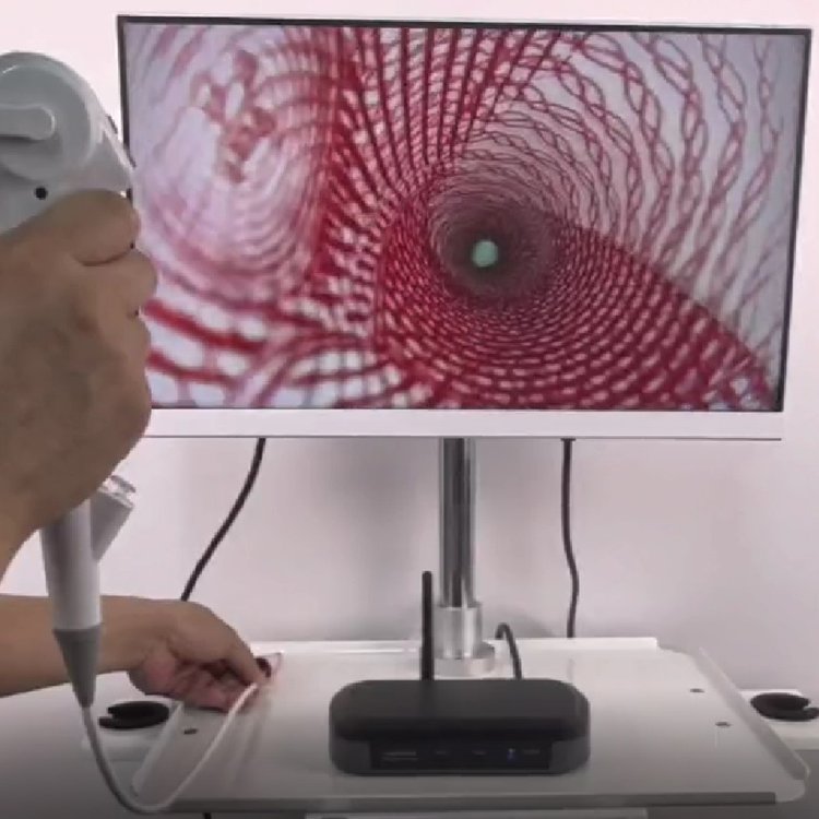 ODM And OEM high quality Wireless Medical Endoscope Clip Suction Animal Veterinary Endoscope