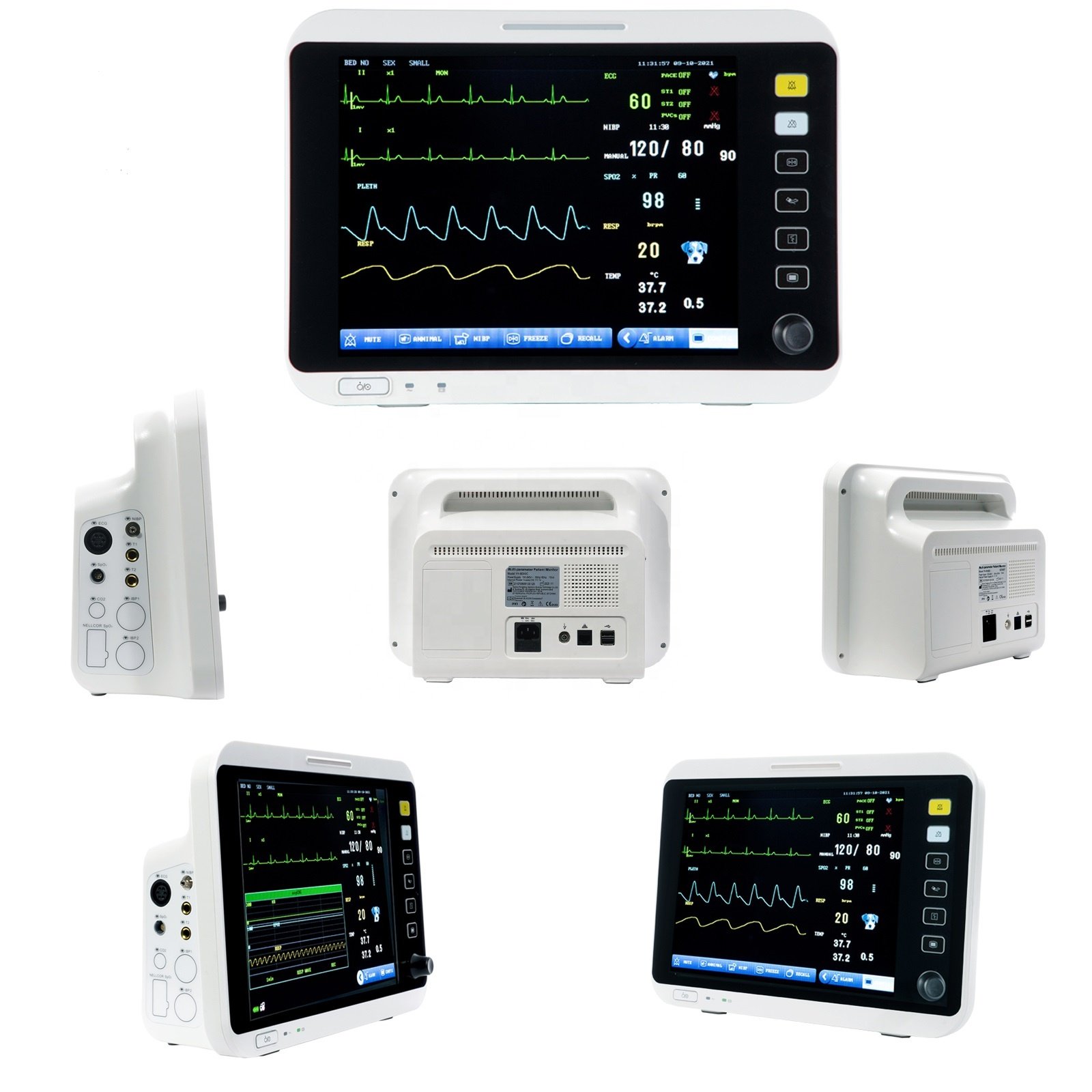 High Quality OEM ODM Vet Multiparameter Monitor Vital Signs Monitors With Co2 Capnograph NIBP TEMP Function Veterinary Clinic