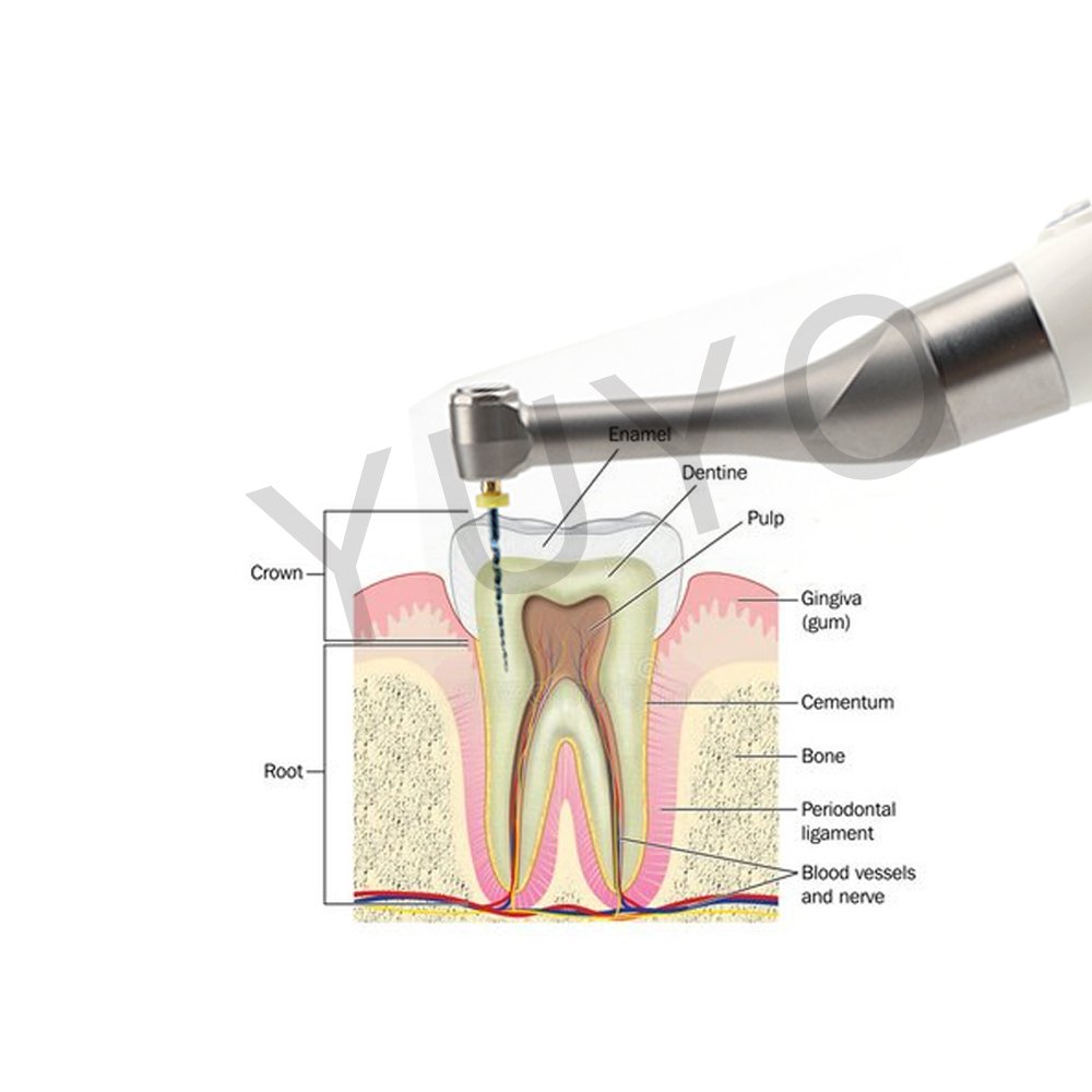 Dental Wireless Endomotor with Apex Locator 1:1 Root Canal Endodontic Treatment Handpiece