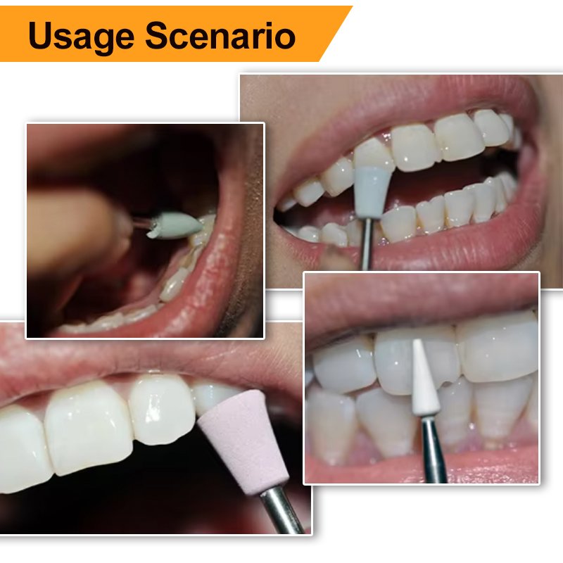 High-Quality Zirconia Diamond Burs for Dental Use Specifically Designed for Polishing Ceramic Teeth with Low-Speed Handpieces