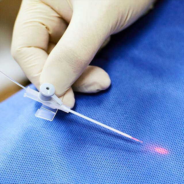 Surgery accessories 400um 600um disposibel endolaser lipolysis endolaser evlt PLDD medical radial conical fiber