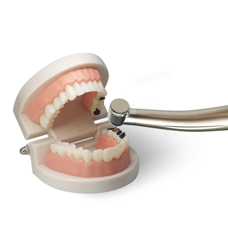 WEDENT Dental 2/4 Holes Push Button NSK-Coupling High Speed Dental Air-driven Handpiece with Open-type Cartridge