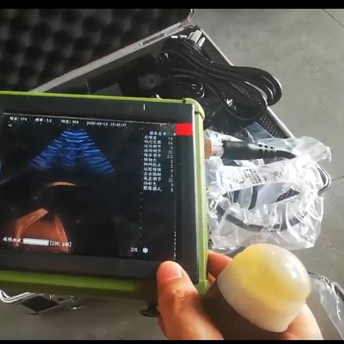 Large Screen High Definition Pig Medical Handheld Veterinary Portable B Ultrasound Scanner Pregnancy Test Kit