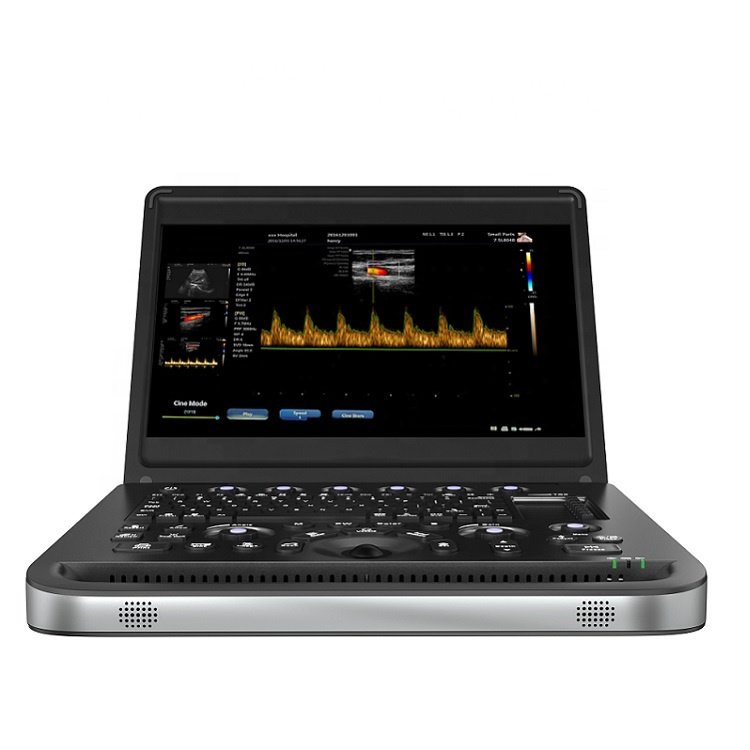 cheap price portable ultrasound scanner color doppler ultrasound machine 3d 4d function 15inch medical ultrasound instruments