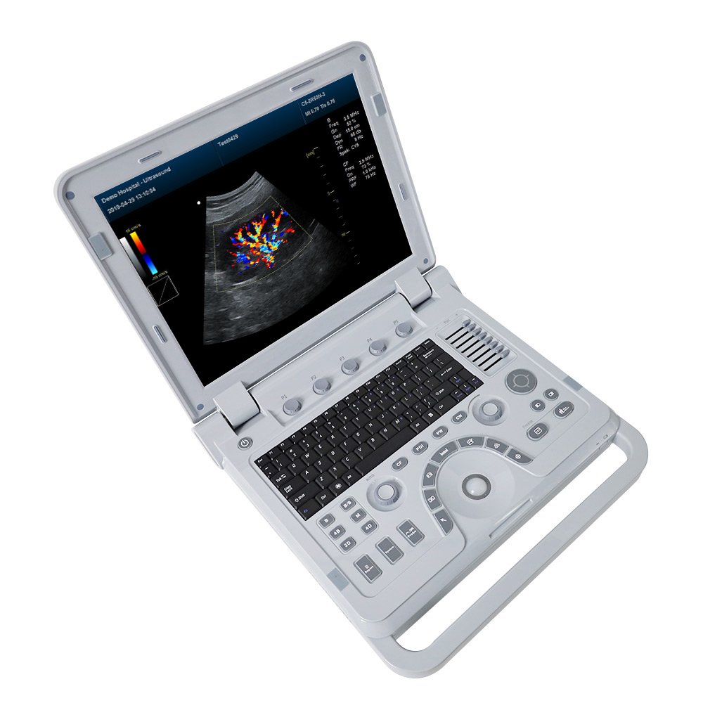 CONTEC CMS1700B-VET veterinary instruments for pregnancy test detector portable ultrasound scanner v16