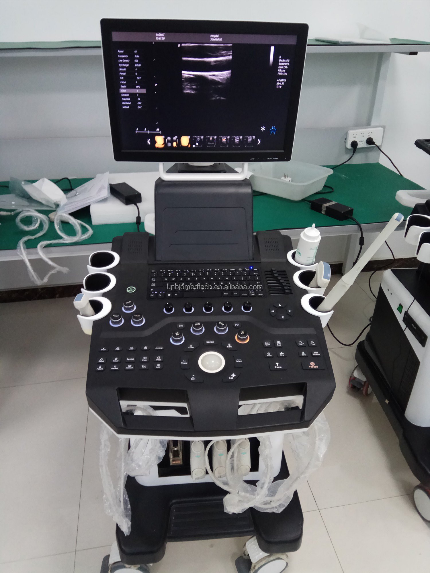 Advanced Veterinary Handheld Ultrasound Machine