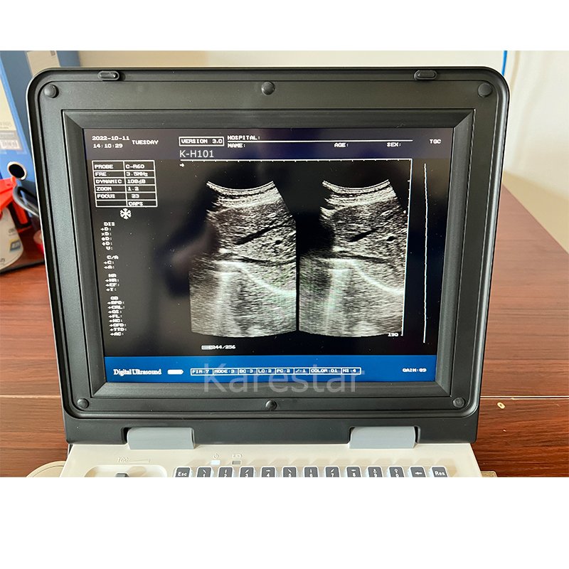 Karestar Portable Ultrasound Black and White Ultrasound Machine B/W Laptop Animal Medical Instrument Digital Scanner