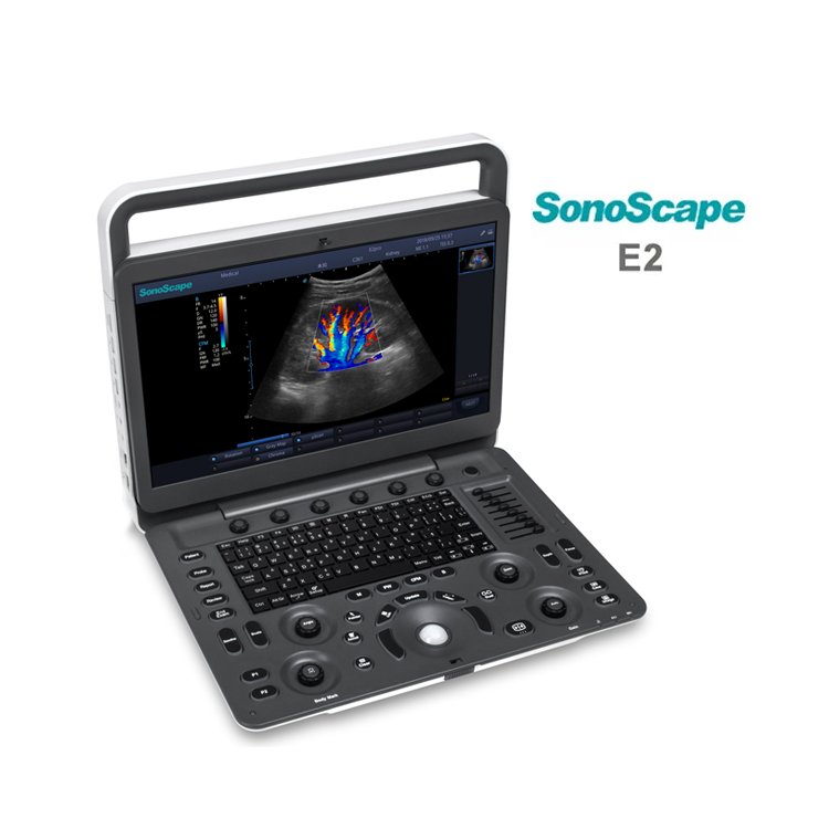 2023 Medsinglong Medical Ultrasound Instrument 3D 4D Portable Sonoscape E2 ultrasound machine price for sale