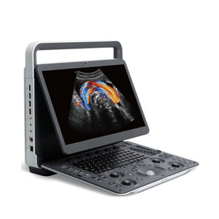 2023 Medsinglong Medical Ultrasound Instrument 3D 4D Portable Sonoscape E2 ultrasound machine price for sale