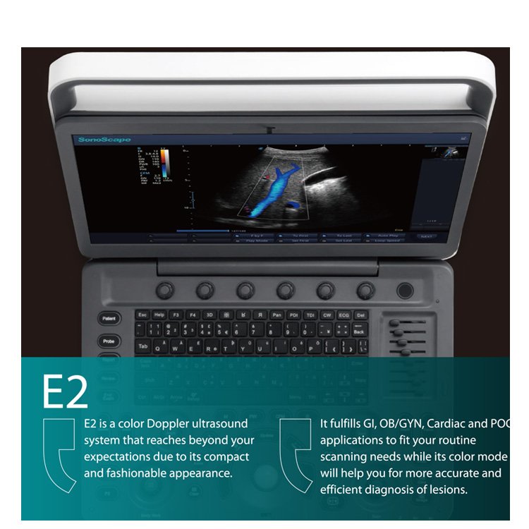2023 Medsinglong Medical Ultrasound Instrument 3D 4D Portable Sonoscape E2 ultrasound machine price for sale