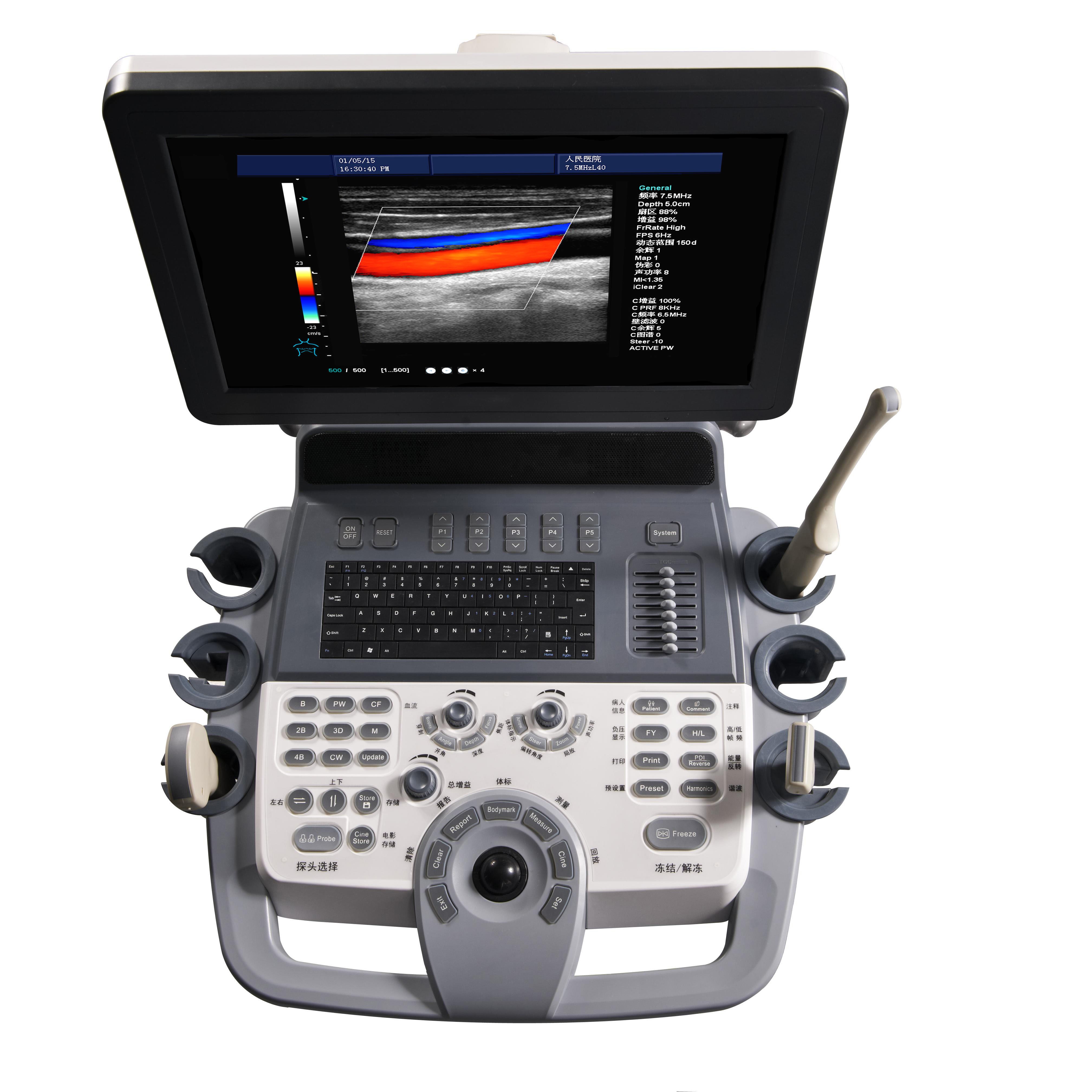 Medical Ultrasound Machine Hospital Color Doppler Diagnostic 4D Trolley Ultrasound Machine