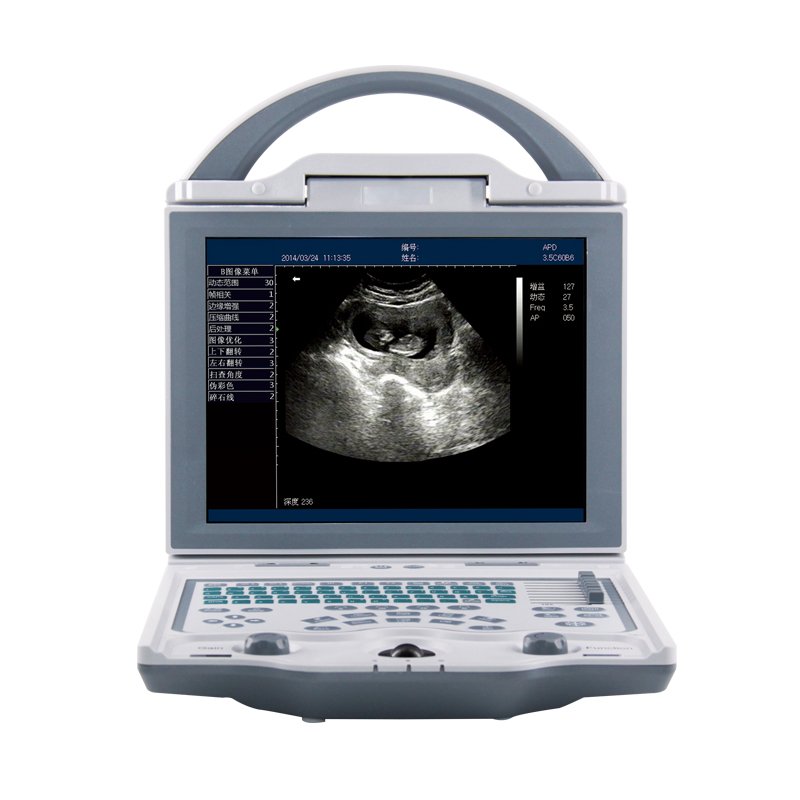 B-Ultrasound Scanner Machine ultrasound machine animal&veterinary portable ultrasound machine