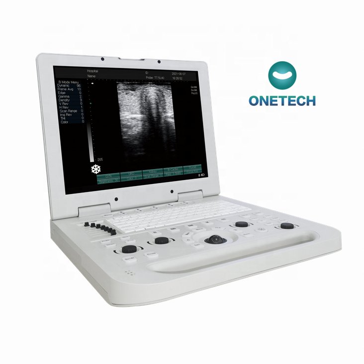 B17 Portable ultrasound scanner Medical Ultrasound Machine ultrasound instruments