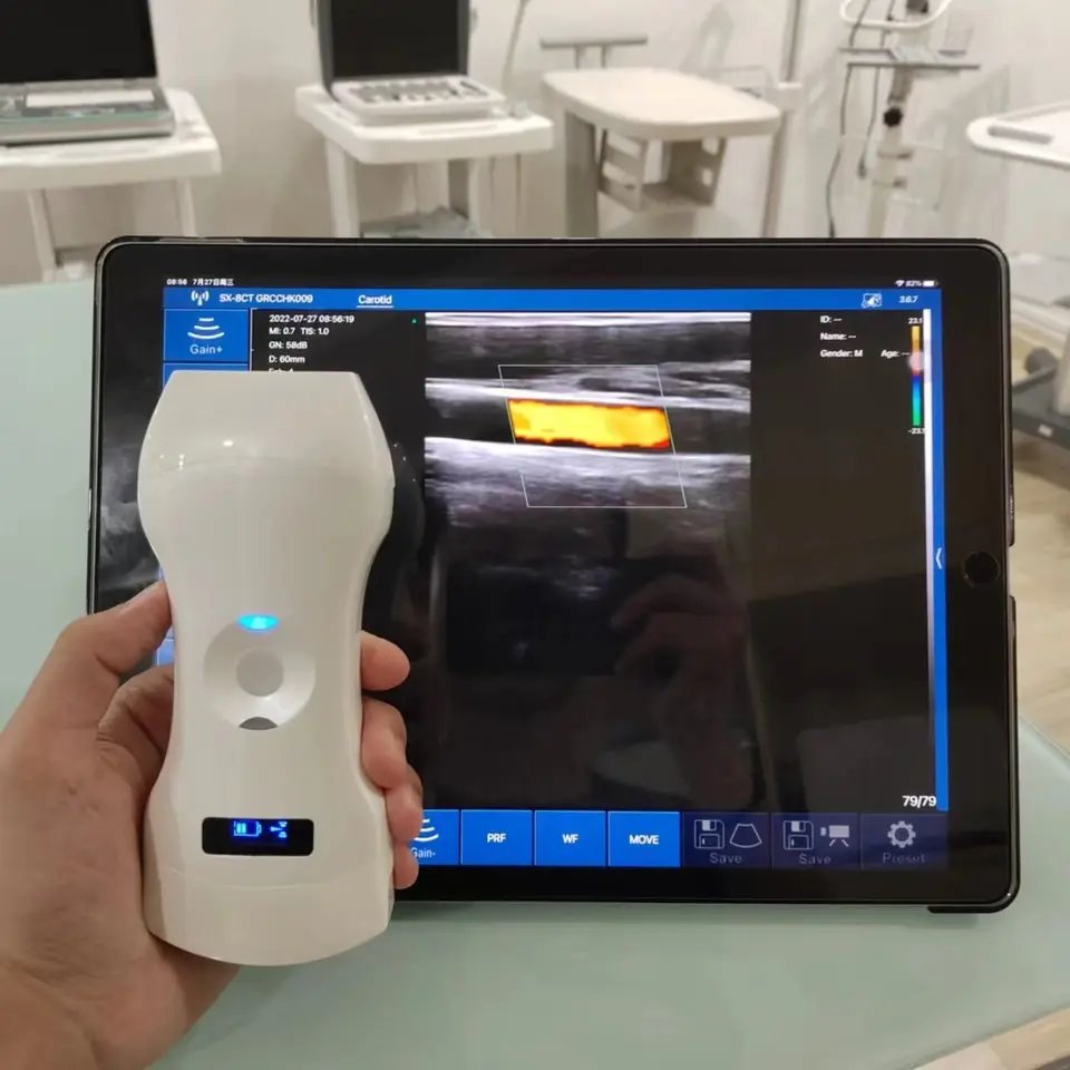 Vet color Doppler wireless linear ultrasound 192 elements 10MHz-12MHz linear ultrasonic probe medical ultrasound instruments