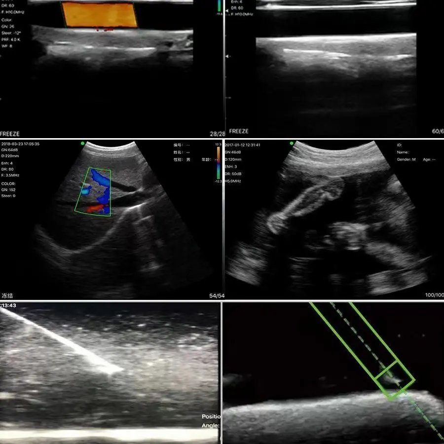 Vet color Doppler wireless linear ultrasound 192 elements 10MHz-12MHz linear ultrasonic probe medical ultrasound instruments