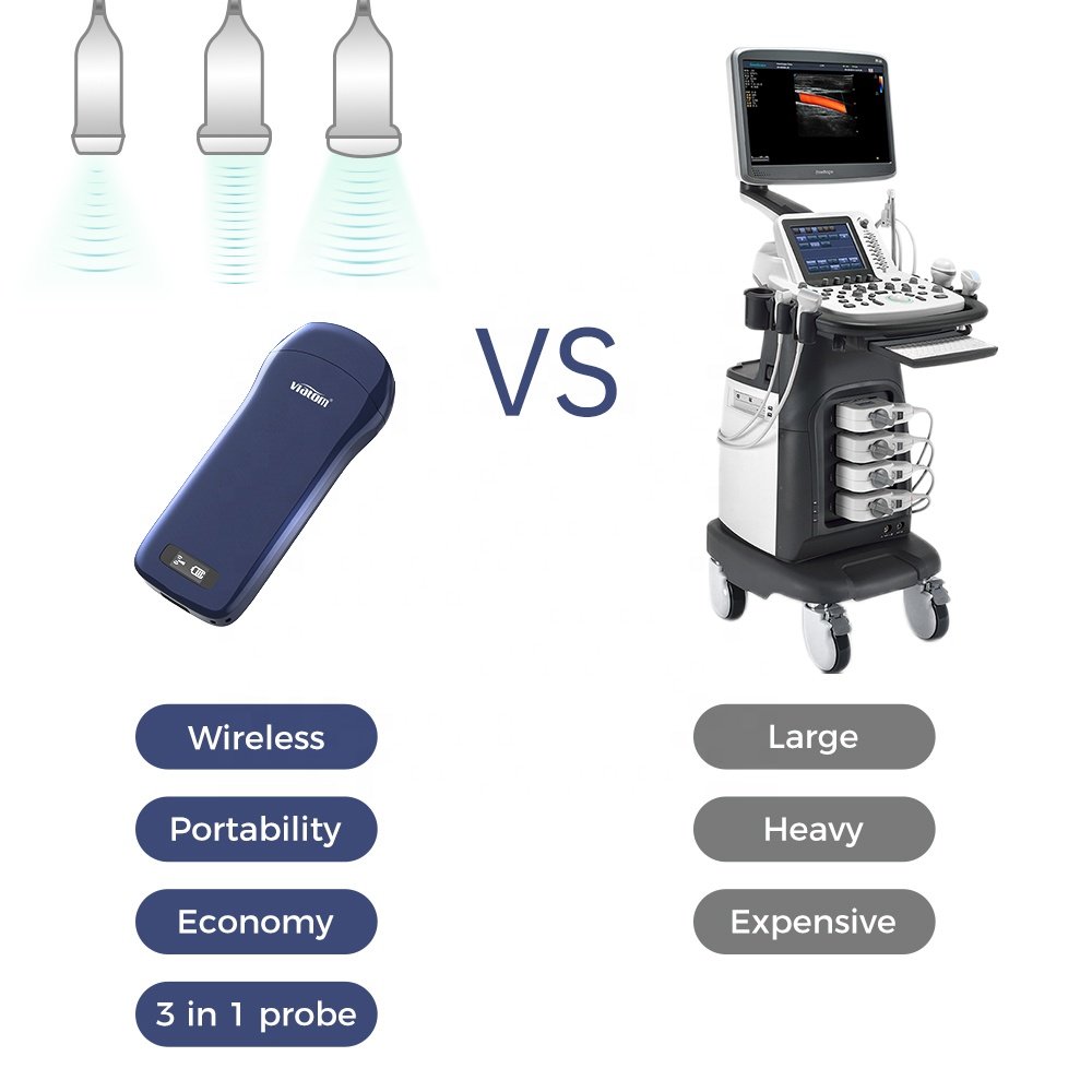 Viatom C10 Smartphone Ultrasound Price Wireless Charing Scanner Machine Linear/Convex/Cardiac 3-in 1 Probe Portable Ultrasound