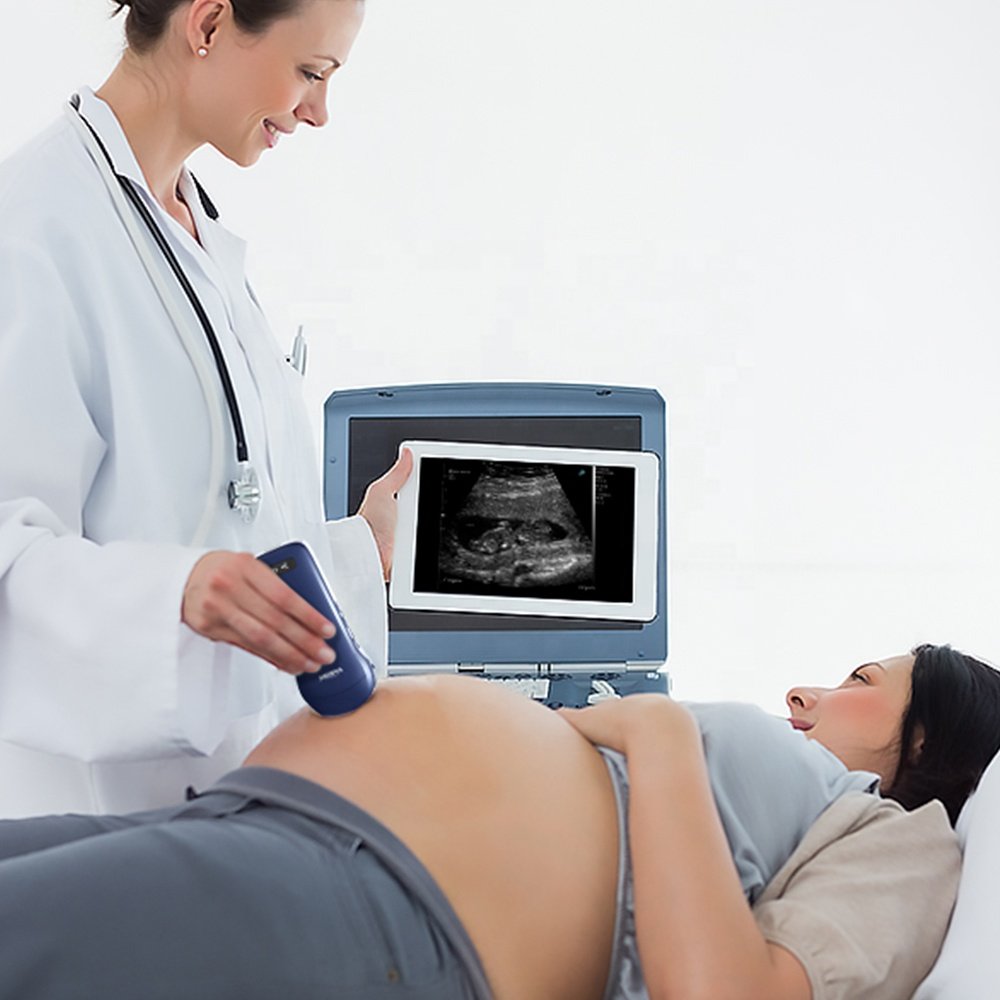 Viatom C10 Smartphone Ultrasound Price Wireless Charing Scanner Machine Linear/Convex/Cardiac 3-in 1 Probe Portable Ultrasound