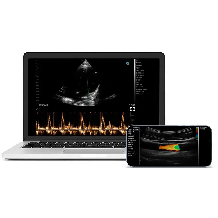 Viatom C10 Smartphone Ultrasound Price Wireless Charing Scanner Machine Linear/Convex/Cardiac 3-in 1 Probe Portable Ultrasound
