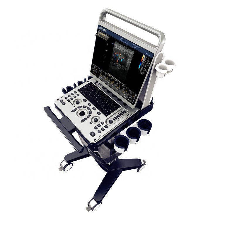 medical ultrasound instruments ebit30 portable ultrasound machine