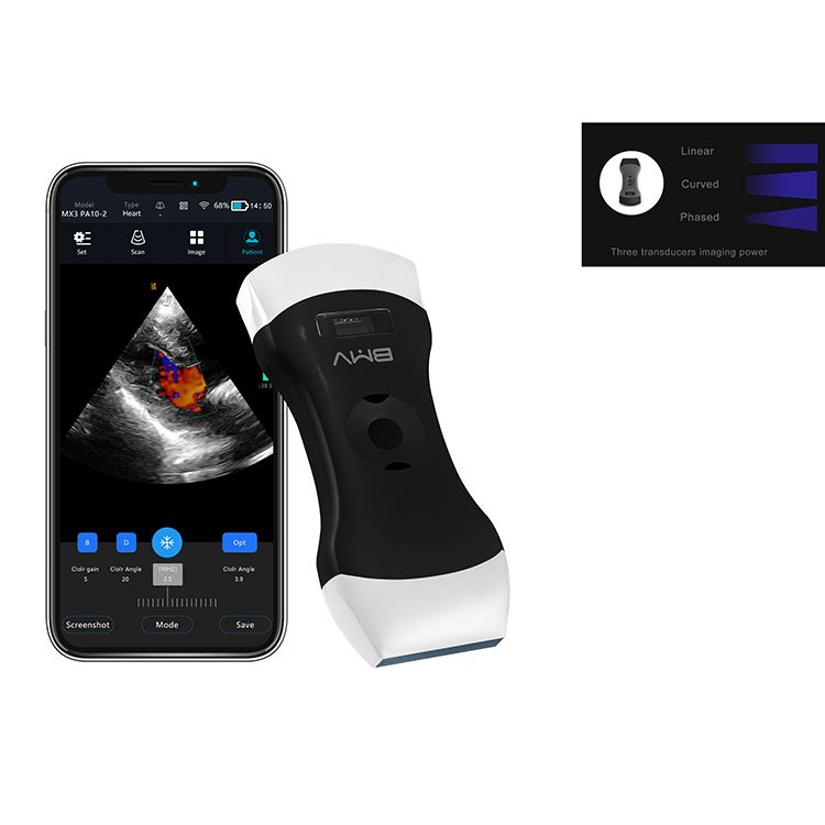 UEM Medical wireless Ultrasound Instrument MSK OB/GYN Ultrasound Scanner MX3 Portable Ultrasound Machine