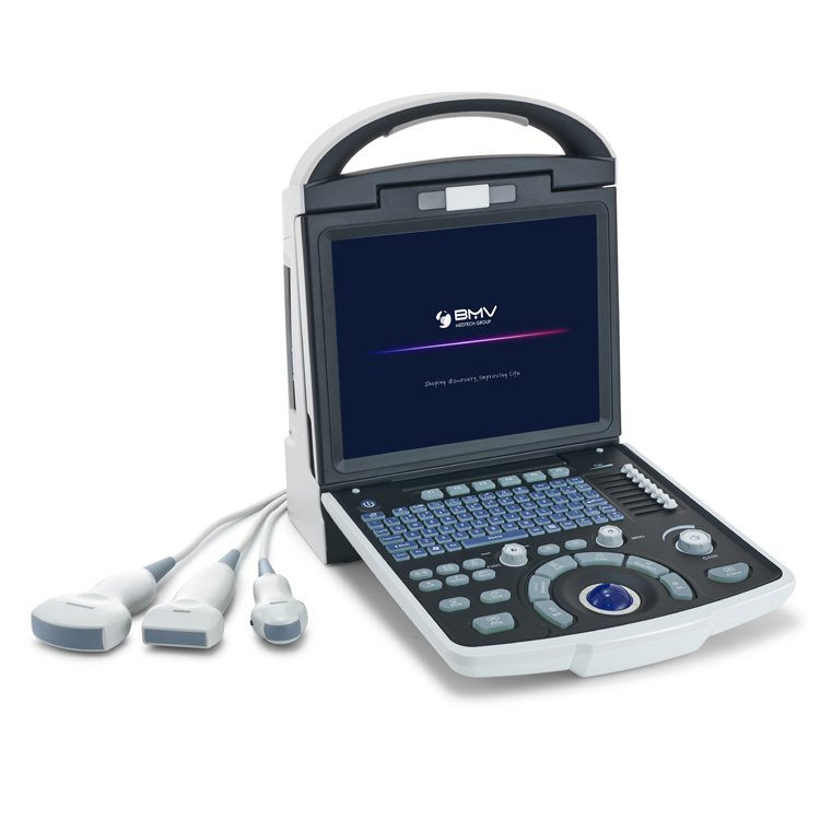 Medical Ultrasound Instruments Full Digital Color Doppler Ultrasound Diagnostic System Ultrasound