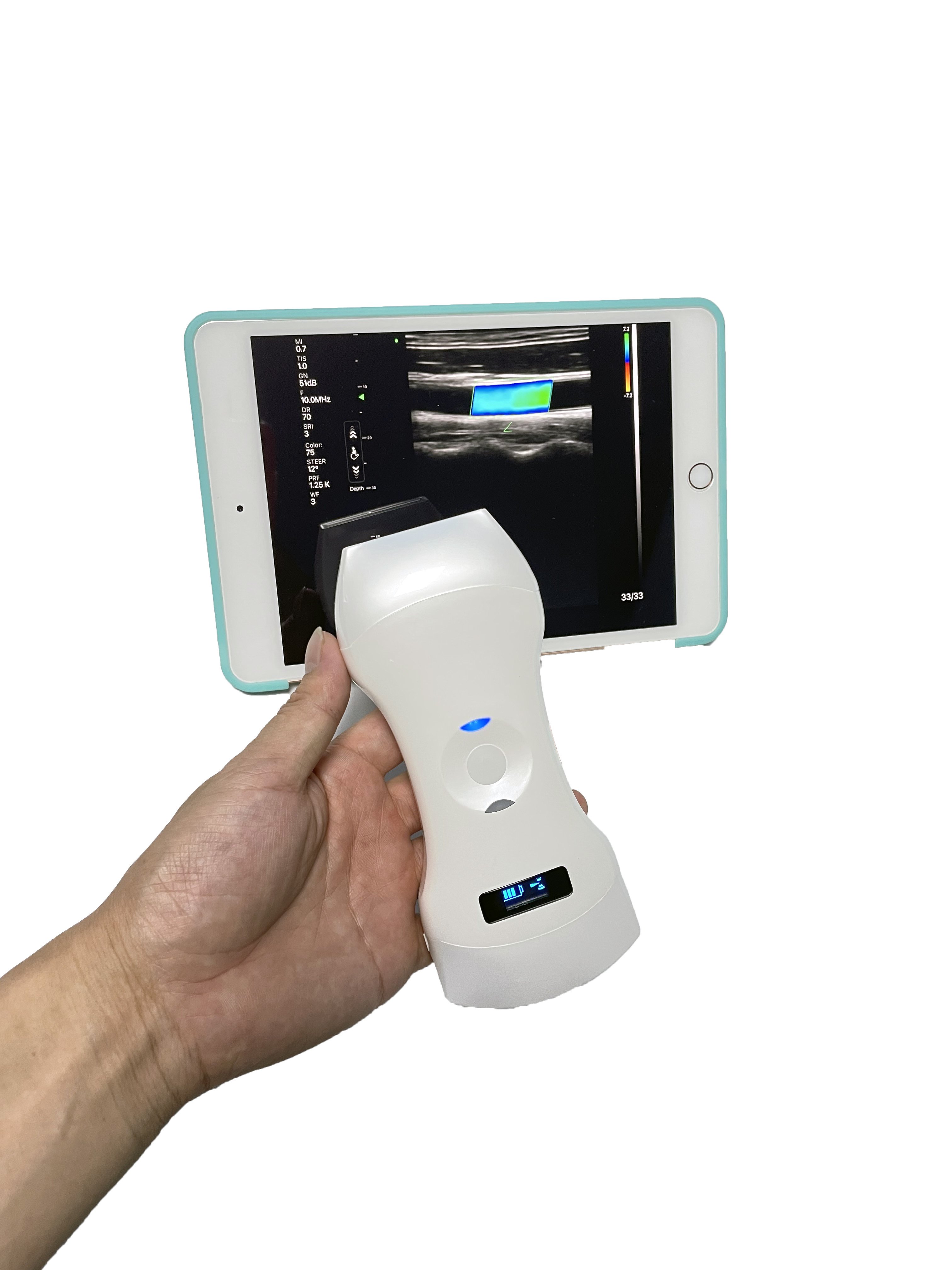 Wireless Medical Ultrasound Probe Portable and Convenient for Diagnostic Imaging MSLAA114