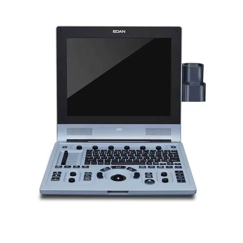 Edan U60 ultrasonido Edan ultrasound machine