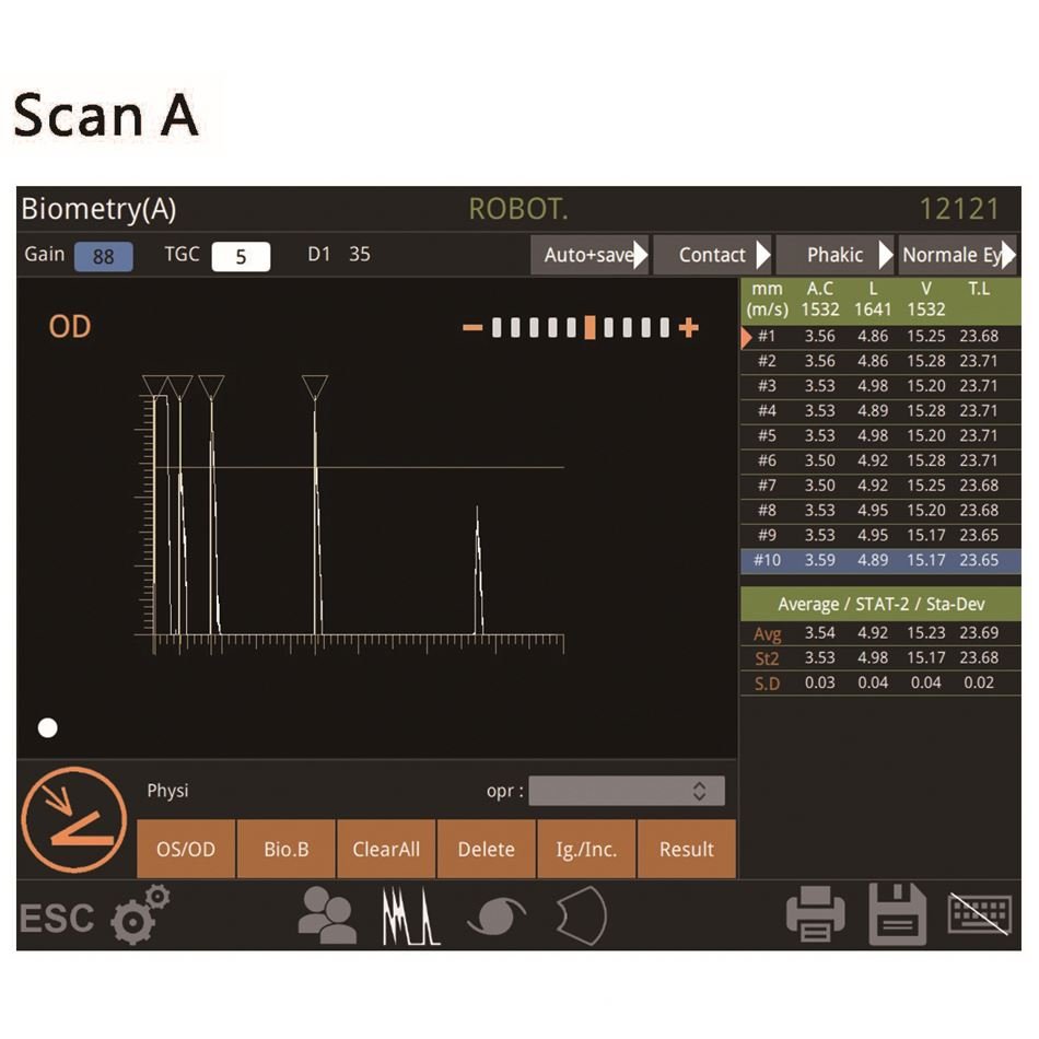 Ophthalmic Instrument A B Scan Retiwave-1000 Low Price Ultrasound Scanner