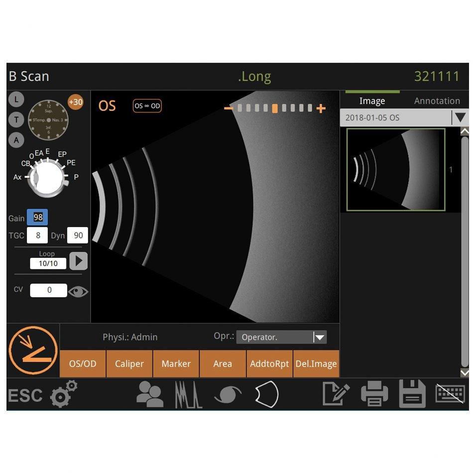 Ophthalmic Instrument A B Scan Retiwave-1000 Low Price Ultrasound Scanner