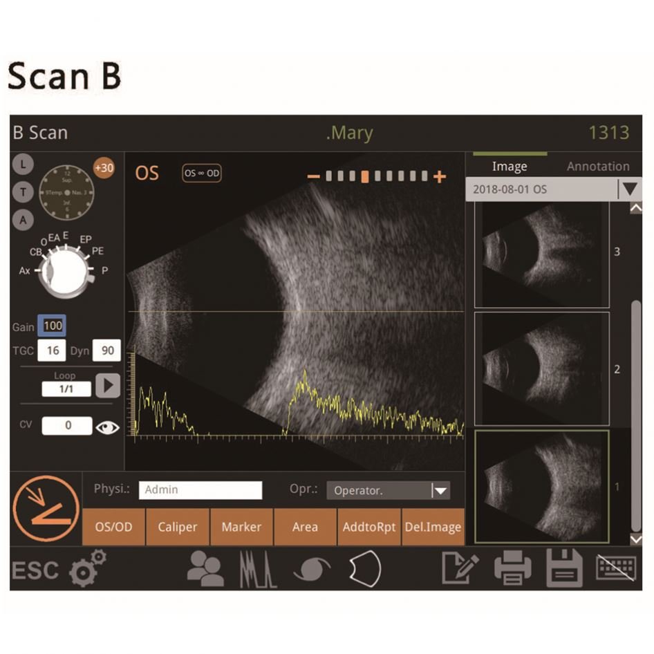 Ophthalmic Instrument A B Scan Retiwave-1000 Low Price Ultrasound Scanner