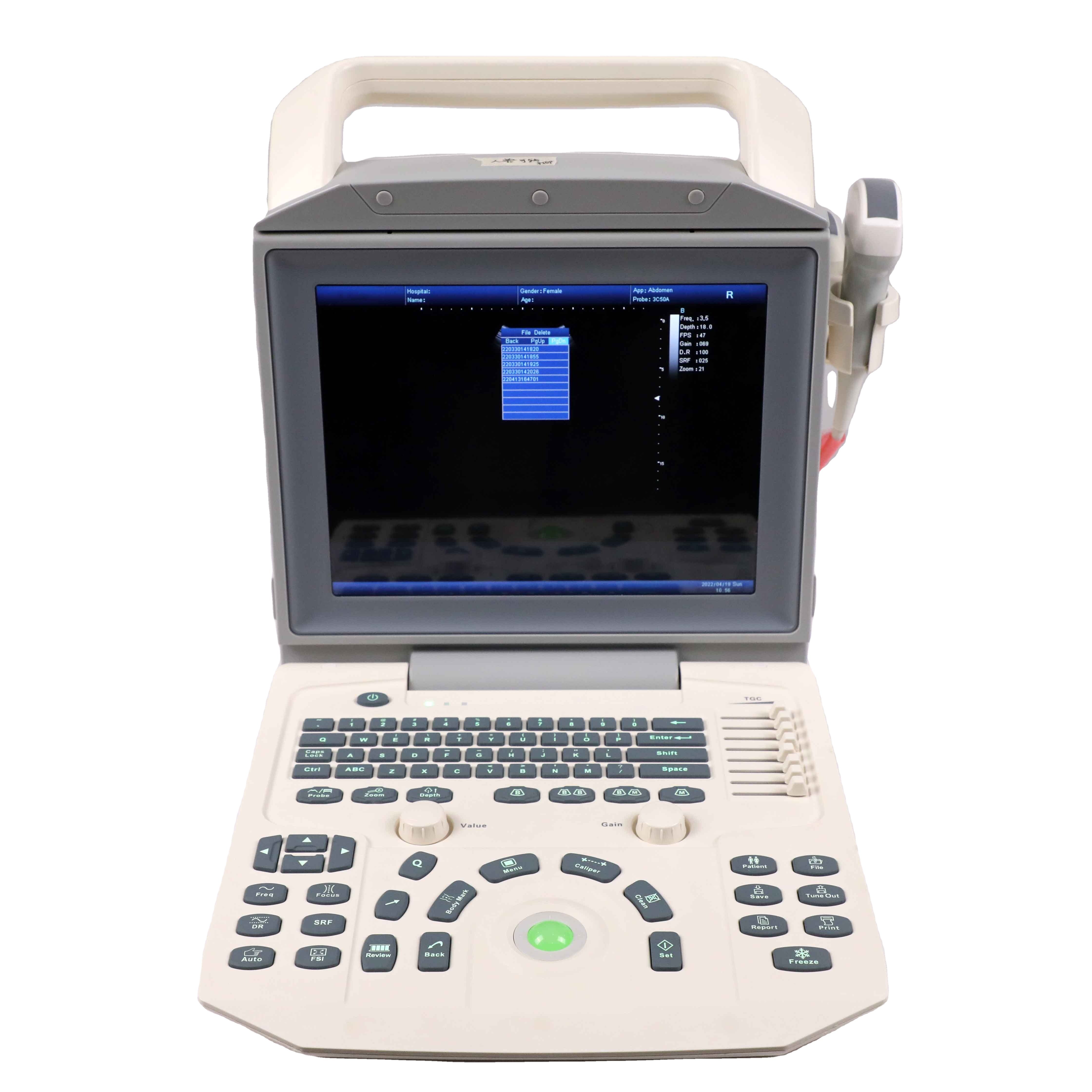 Digital Diagnostic Ultrasound Machine Medical Ultrasound Instruments