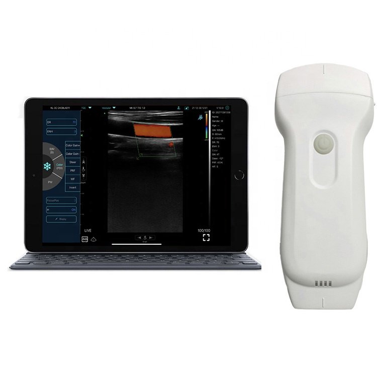 3 in 1wireless double head ultrasound sonography 128 double head wireless ultrasound