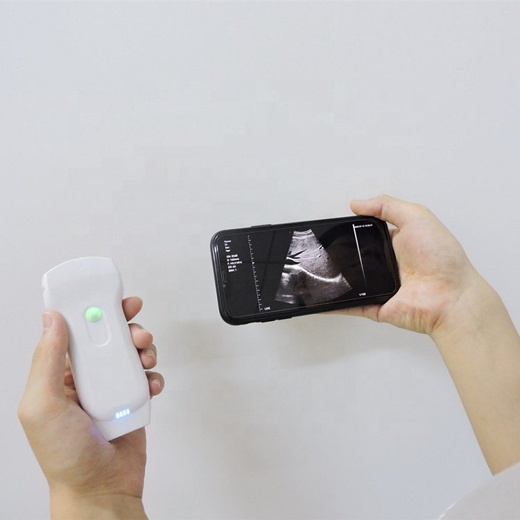 3 in 1wireless double head ultrasound sonography 128 double head wireless ultrasound