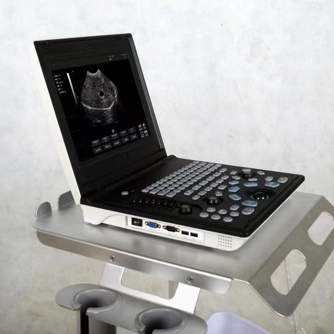 Hospital Medical Trolley Cart Monitoring Instrument Monitor Cart Ultrasound Machine Trolley