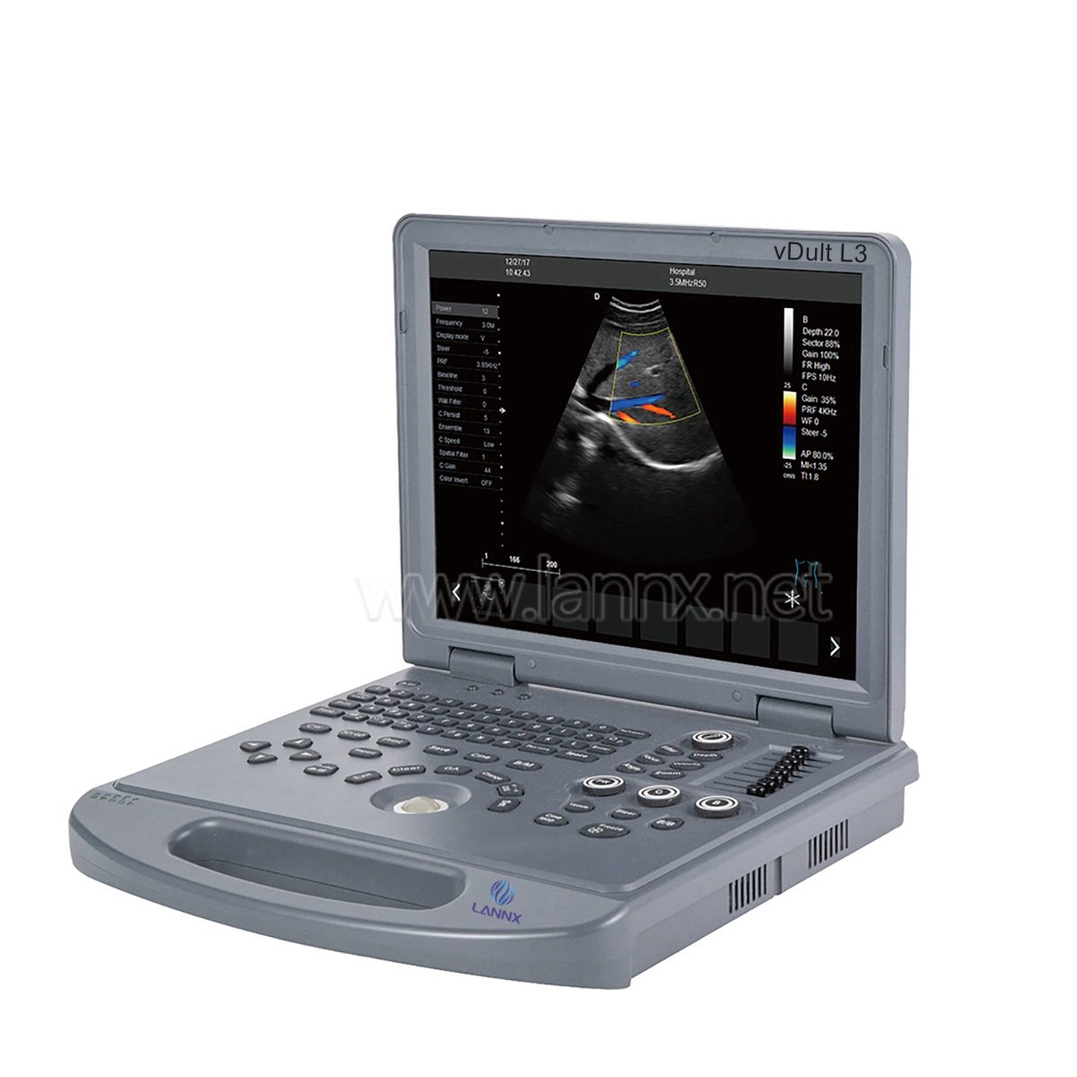 Portable animal Color Doppler veterinary ultrasound machine ecografo veterinary veterinary ultrasound scanner price veterinary