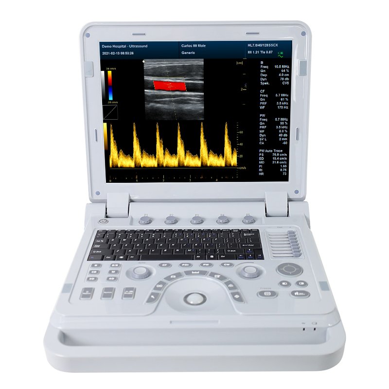CONTEC CMS1700B doppler portable 3D 4D Echocardiography ultrasound machine
