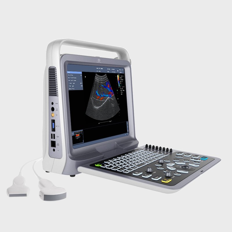 Handheld USB&WiFi lineal convexo cardiaco probe 3 in 1 transductor Color Doppler Portable Ultrasound Scanner Machine