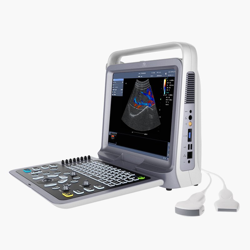 Handheld USB&WiFi lineal convexo cardiaco probe 3 in 1 transductor Color Doppler Portable Ultrasound Scanner Machine