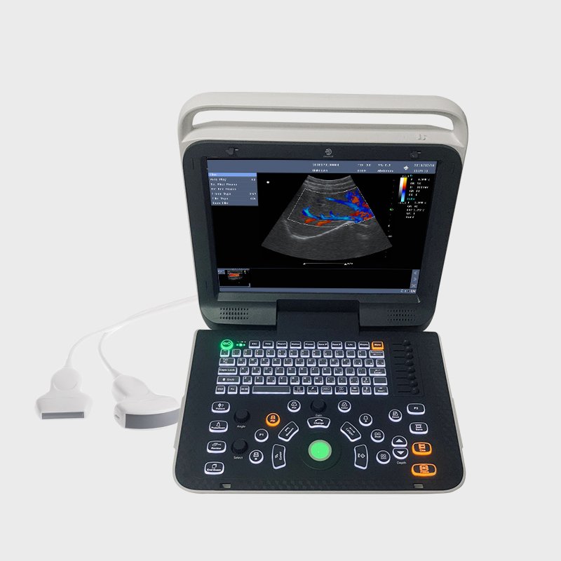 Handheld USB&WiFi lineal convexo cardiaco probe 3 in 1 transductor Color Doppler Portable Ultrasound Scanner Machine