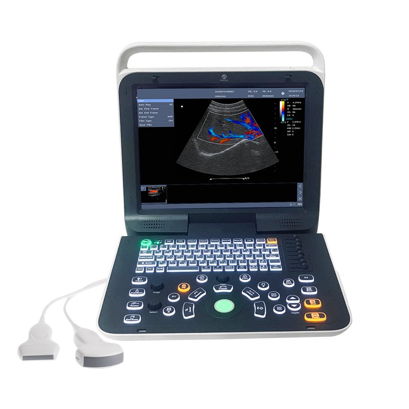 Handheld USB&WiFi lineal convexo cardiaco probe 3 in 1 transductor Color Doppler Portable Ultrasound Scanner Machine