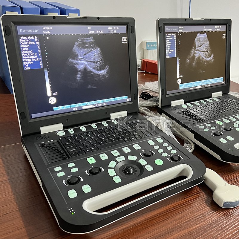 Portable Medical ultrasound instruments Human use Mindray DP10 Black and White ultrasound machine price veterinary Scanner