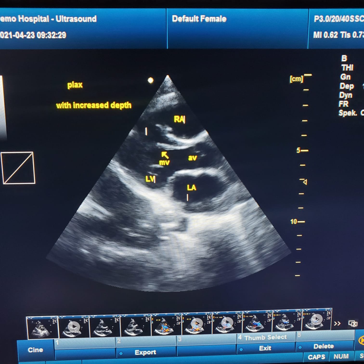 Medical ultrasound instruments SUNBRIGHT 906B veterinary Digital 4D Color Doppler Ultrasound Scanner System ultrasound machine