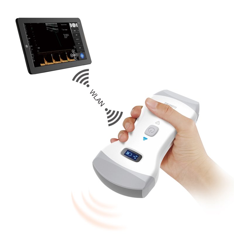 CONTEC ultrasound probe portable ultrasound scanner cms1600b