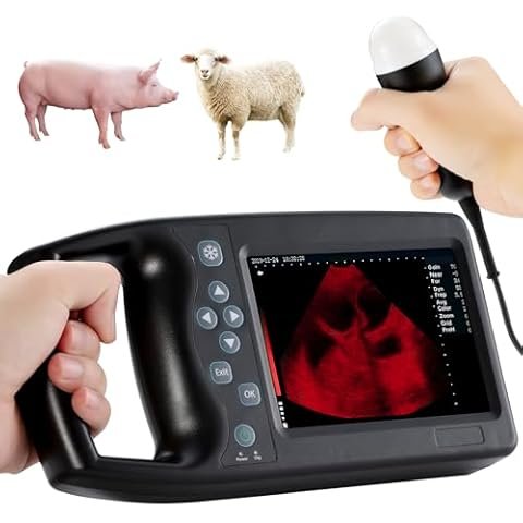 Portable 4d ultrasound For Medical Diagnostic Imaging Center Using Cardiology ultrasound Machine