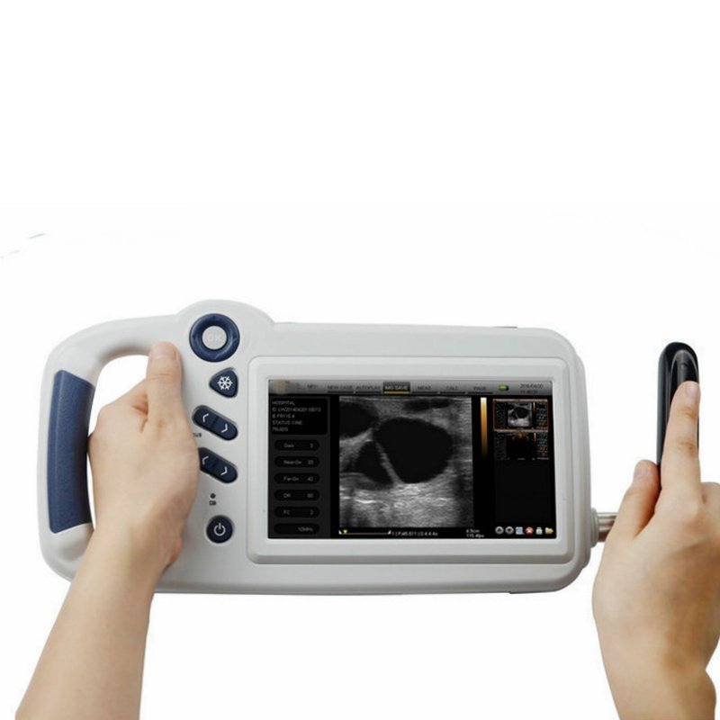 Compact Touch Veterinary Ultrasound Scanner Machine Price