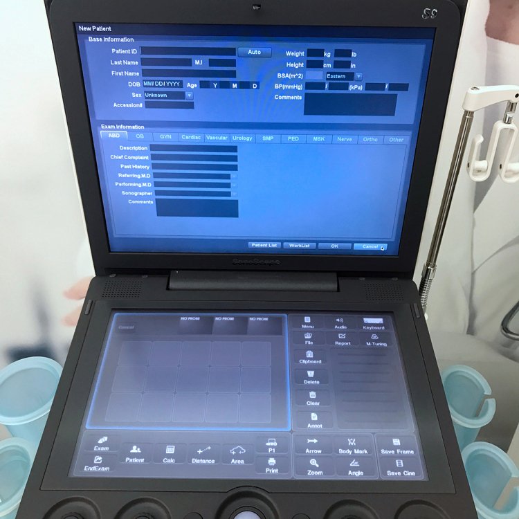 Sonoscape S9 Ultrasound Scanner Price Medical Ultrasound Instruments Portable 3D 4D Color Doppler Ultrasound Machine