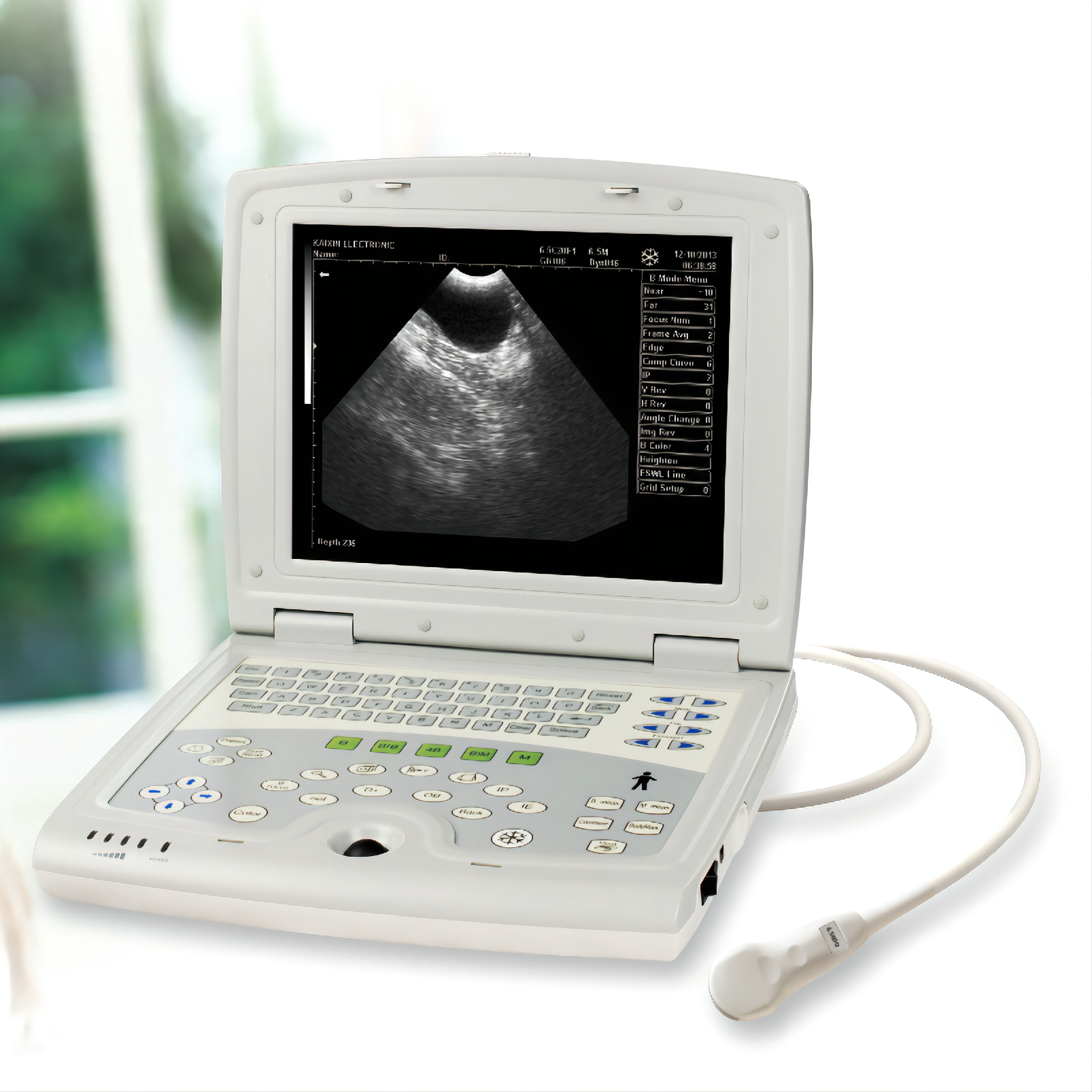 Full Digital Veterinary Ultrasound Scanner KX5000 Portable Machine for Animals